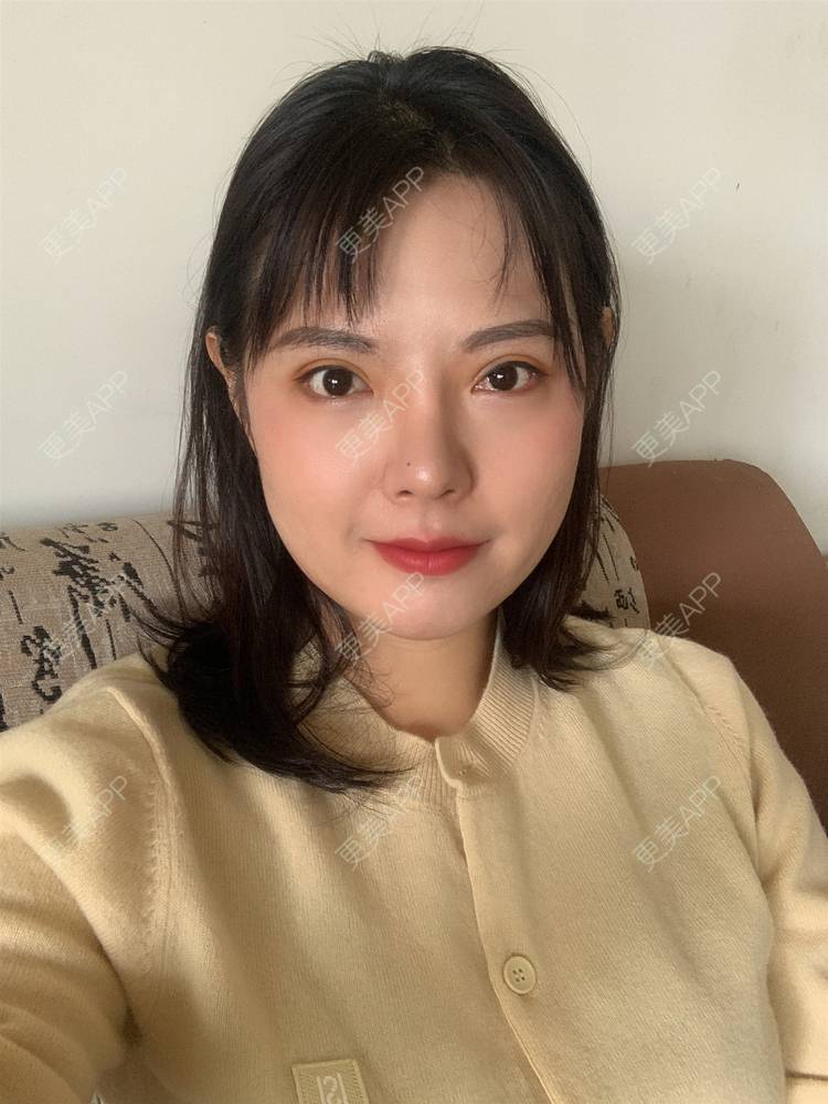 更美 - 落花和忆梦的双眼皮修复经验 | 重庆 | 双眼皮修复