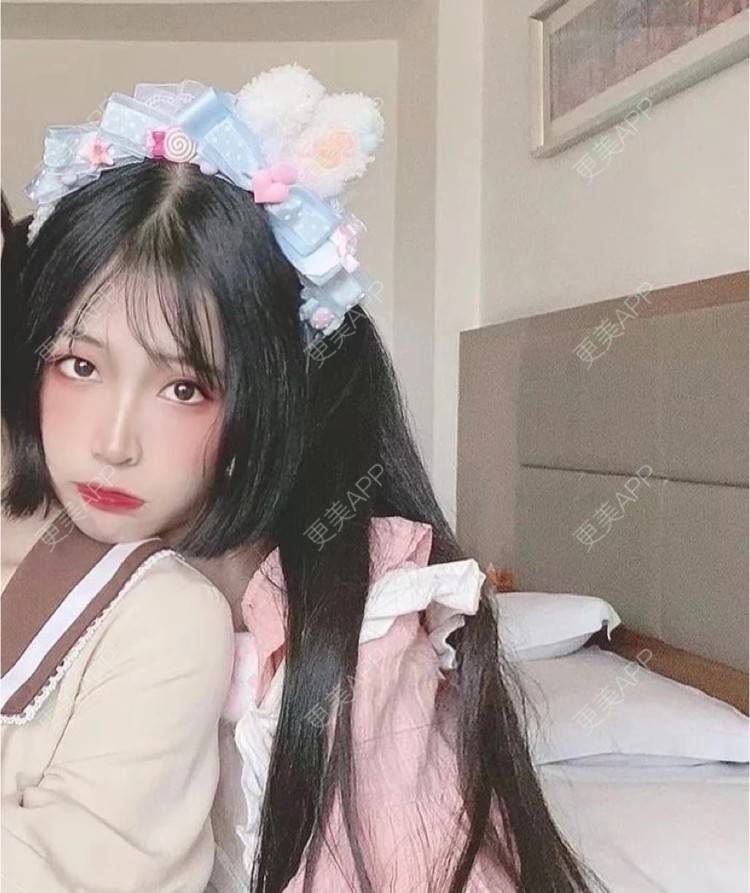 更美 - 更美用户zi7h8WoiBn的玻尿酸卧蚕经验 | 玻尿酸卧蚕 | 杭州