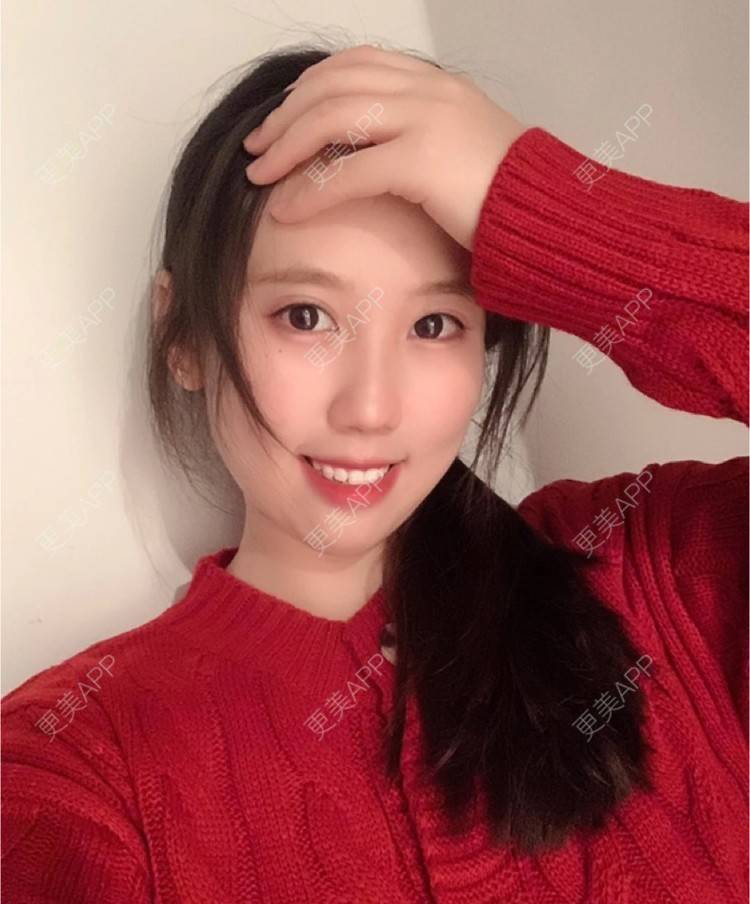 更美 - 更美用户0xJ3SOuKmG的除皱瘦脸经验 | 除皱瘦脸 | 杭州