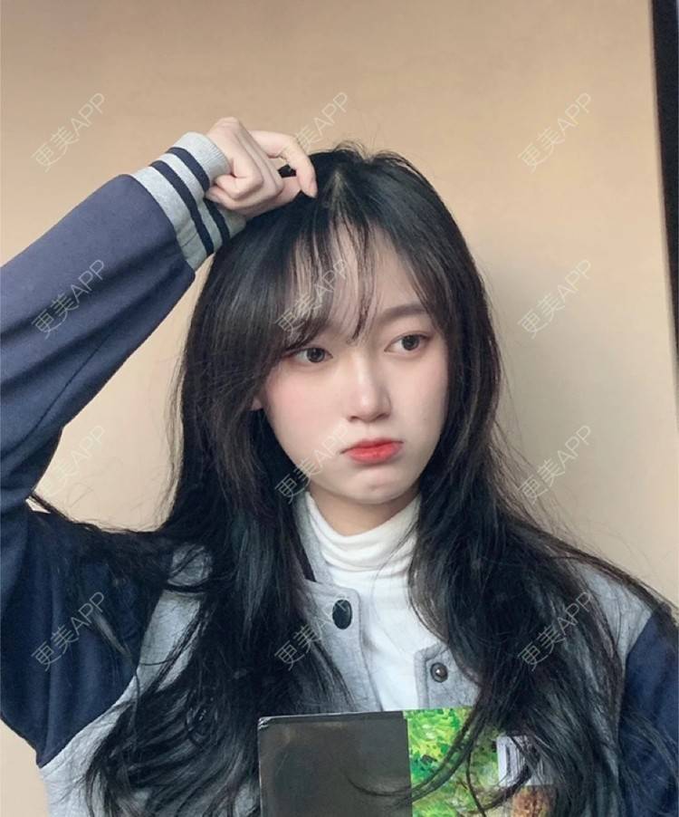 更美 - 更美用户2SolUJsL4l的开内眼角经验 | 杭州 | 开内眼角 | 开外眼角