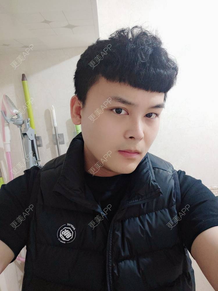 更美 - Mr🐔哦啦啦的隆鼻经验 | 隆鼻 | 鼻部多项 | 重庆