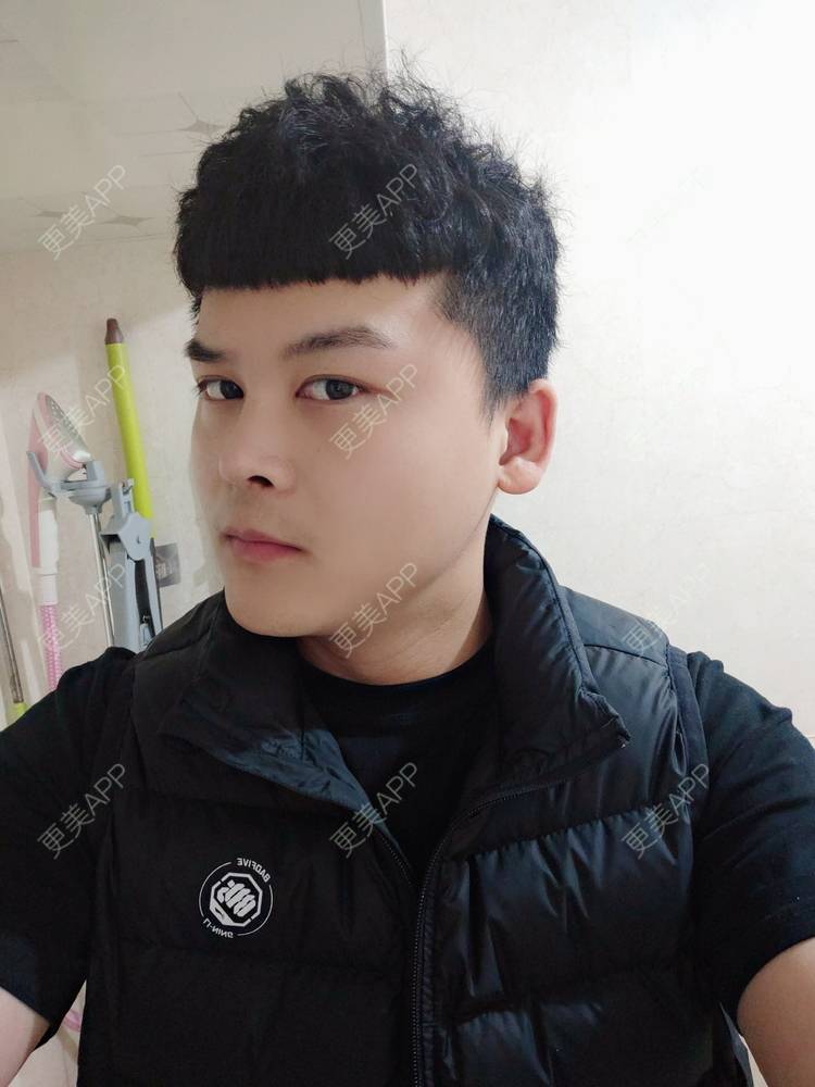 更美 - Mr🐔哦啦啦的隆鼻经验 | 隆鼻 | 鼻部多项 | 重庆
