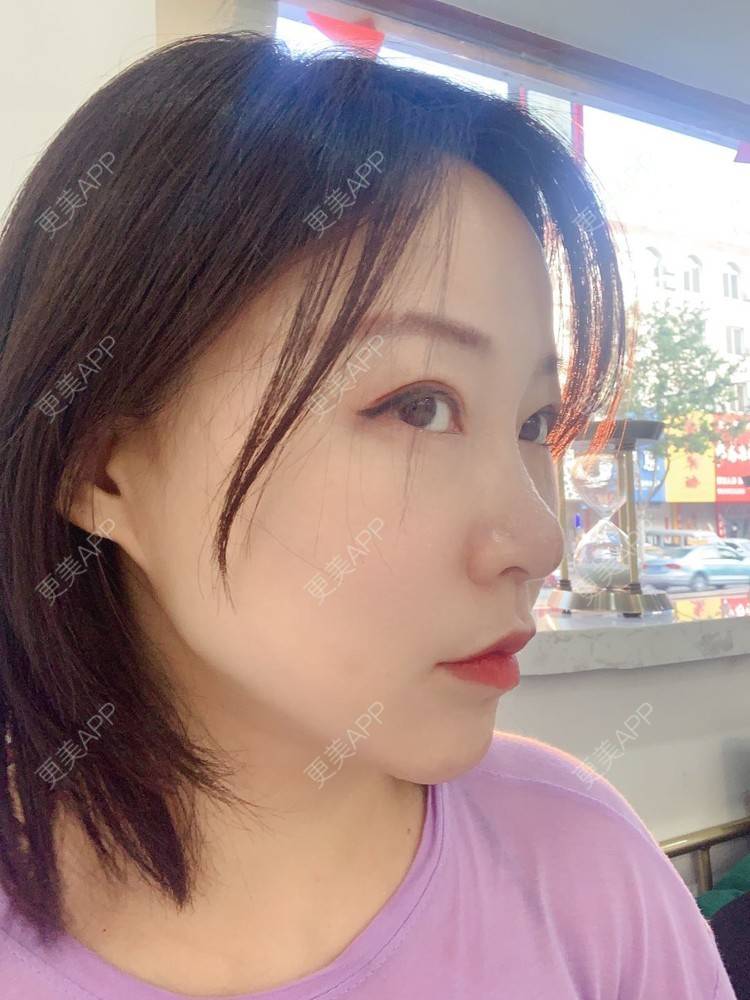 更美 - 更美用户76GAe14Xl1的热玛吉经验 | 热玛吉 | 北京