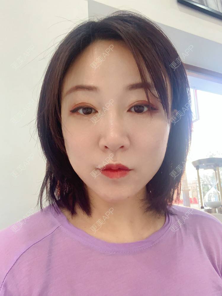 更美 - 更美用户76GAe14Xl1的热玛吉经验 | 热玛吉 | 北京