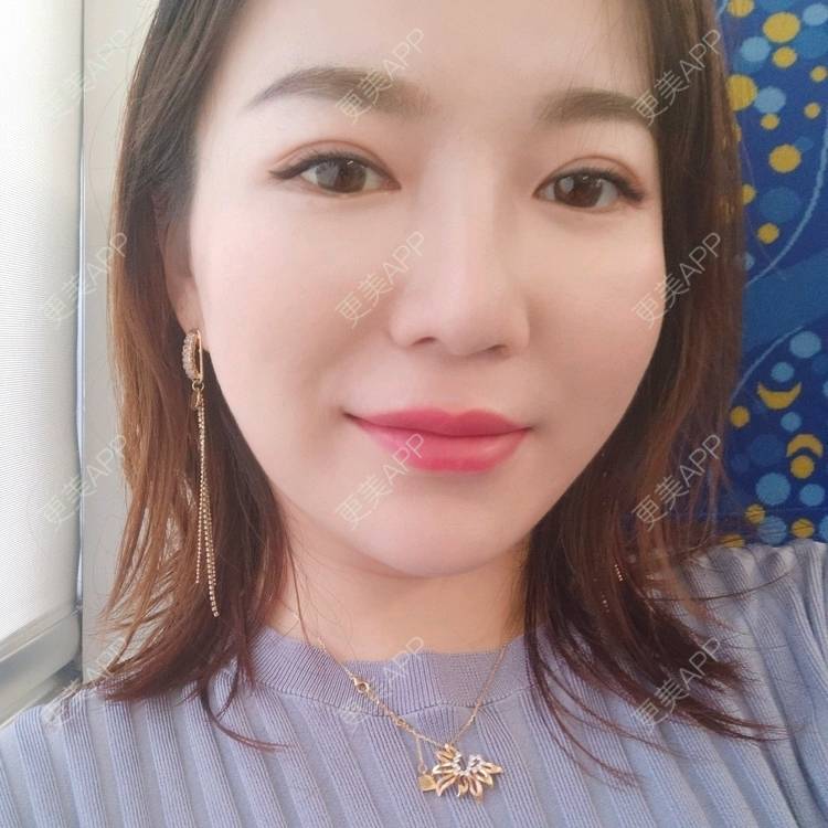 更美 - 更美用户kJHsTQZQuS的吸脂瘦脸经验 | 吸脂瘦脸 | 上海 | 射频溶脂瘦脸