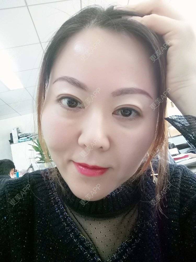 更美 - 更美用户My3CgtLEU9的热玛吉经验 | 热玛吉 | 北京