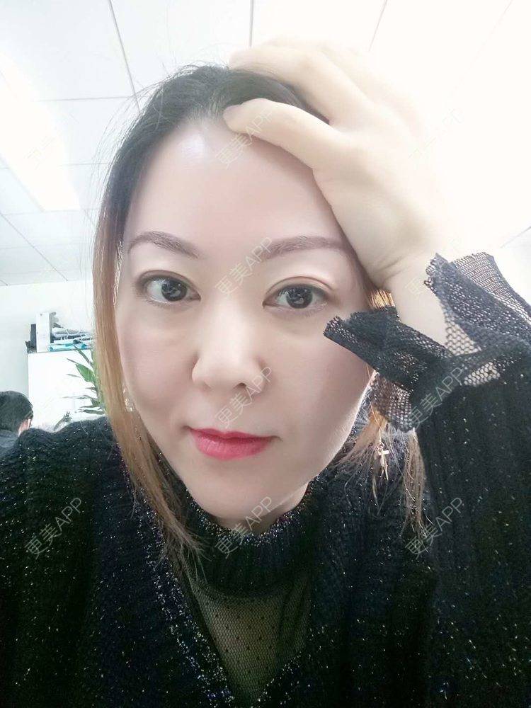 更美 - 更美用户My3CgtLEU9的热玛吉经验 | 热玛吉 | 北京
