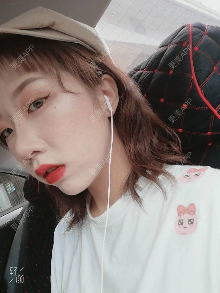 更美 - 更美用户Y99XxcShbA的热玛吉经验 | 热玛吉 | 北京