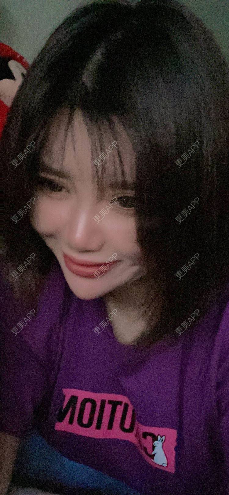 更美 - 更美用户gA8PYjY0w6的热玛吉经验 | 热玛吉 | 北京