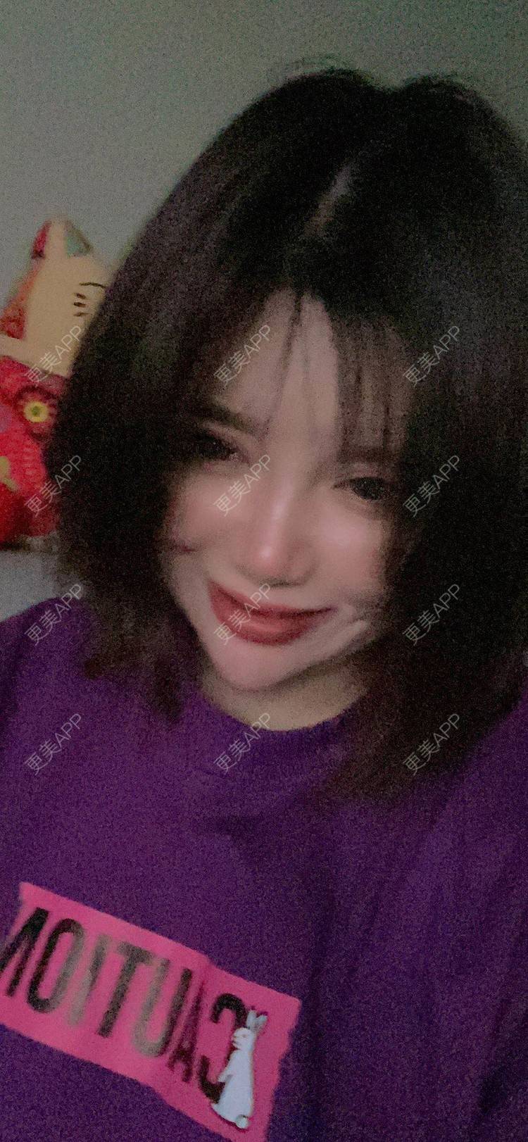 更美 - 更美用户gA8PYjY0w6的热玛吉经验 | 热玛吉 | 北京