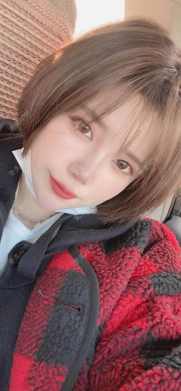 更美 - 更美用户gA8PYjY0w6的热玛吉经验 | 热玛吉 | 北京