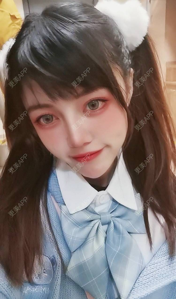 更美 - 一支支支猫的鼻形态修复经验 | 重庆 | 鼻形态修复