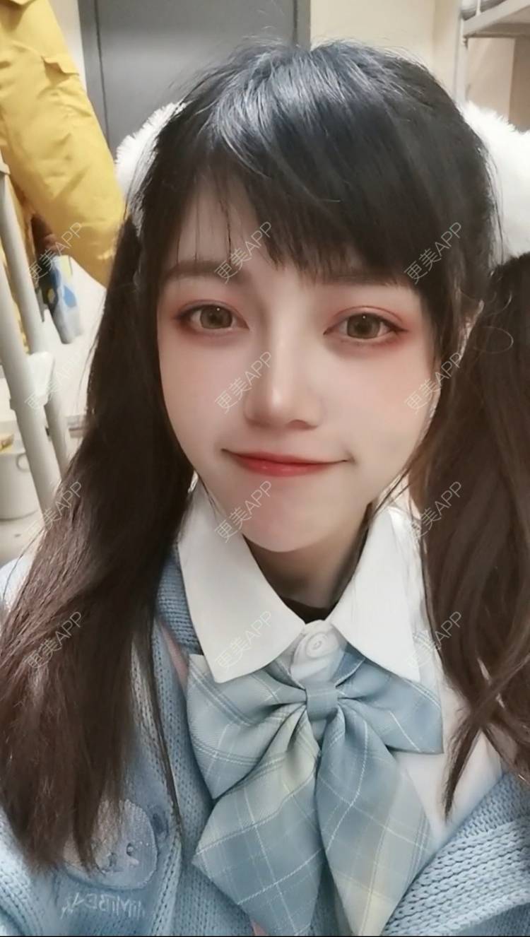 更美 - 一支支支猫的鼻形态修复经验 | 重庆 | 鼻形态修复