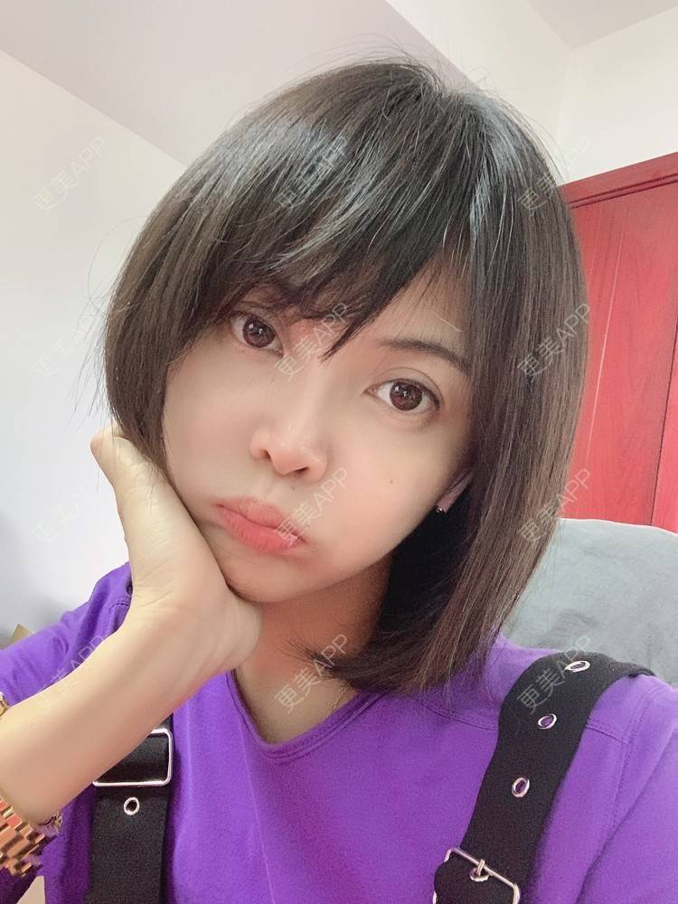 更美 - 更美用户KrKkptdxfh的热玛吉经验 | 热玛吉 | 北京
