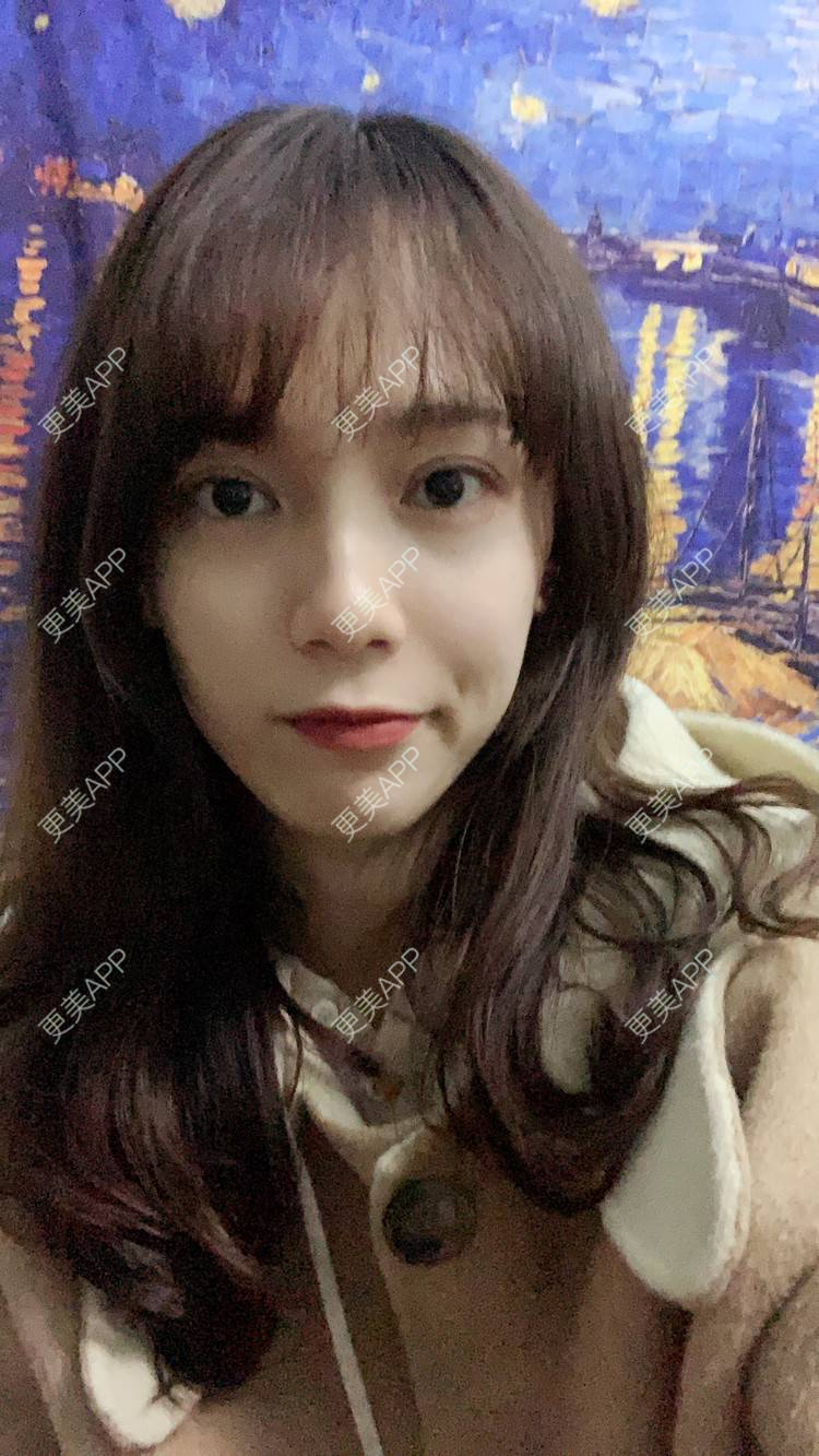 更美 - 更美用户CKvakkeJkI的自体脂肪面部填充经验 | 自体脂肪面部填充 | 郑州