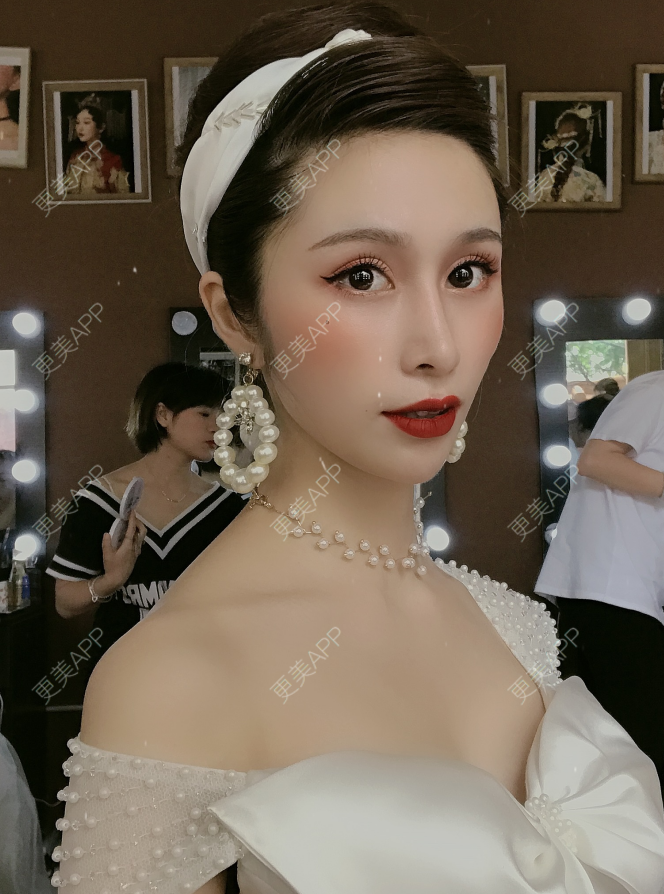 更美 - 更美用户EmhD0DiqON的M唇成形经验 | M唇成形