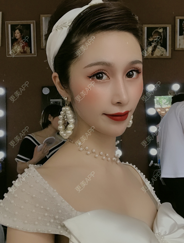 更美 - 更美用户EmhD0DiqON的M唇成形经验 | M唇成形