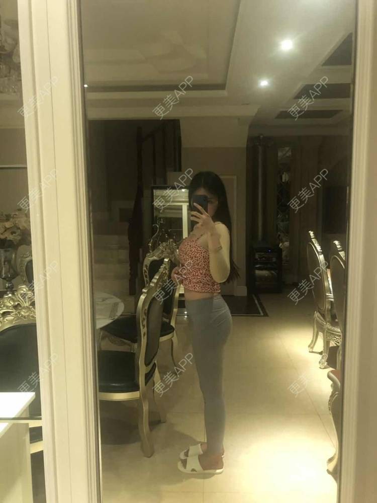 更美 - 冰清心凉的自体脂肪丰臀经验 | 自体脂肪丰臀