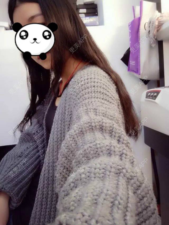 更美 - 眼泪画の婚礼桥的阴唇整形经验 | 上海 | 阴唇整形