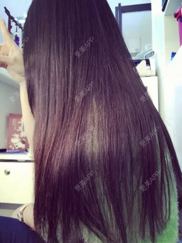 更美 - 眼泪画の婚礼桥的阴唇整形经验 | 上海 | 阴唇整形