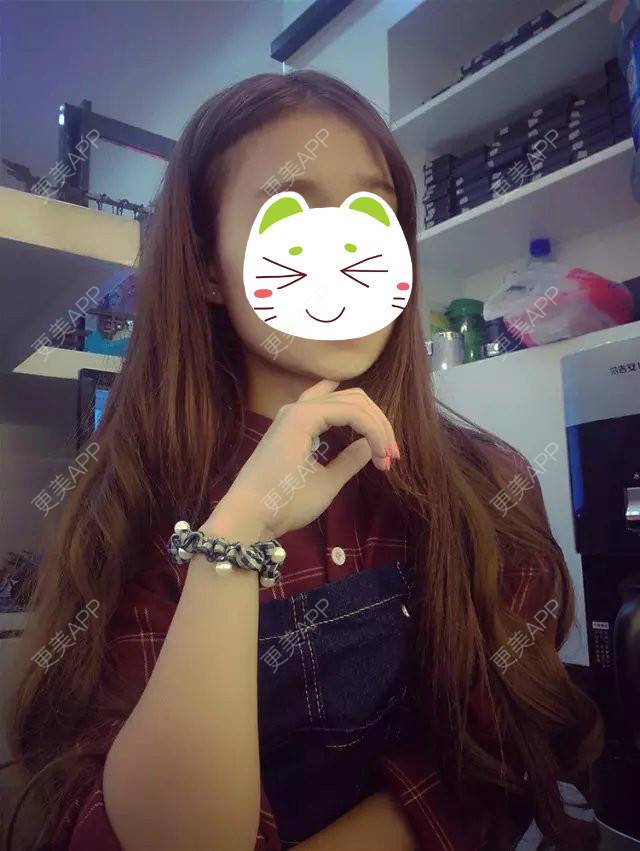 更美 - 眼泪画の婚礼桥的阴唇整形经验 | 上海 | 阴唇整形