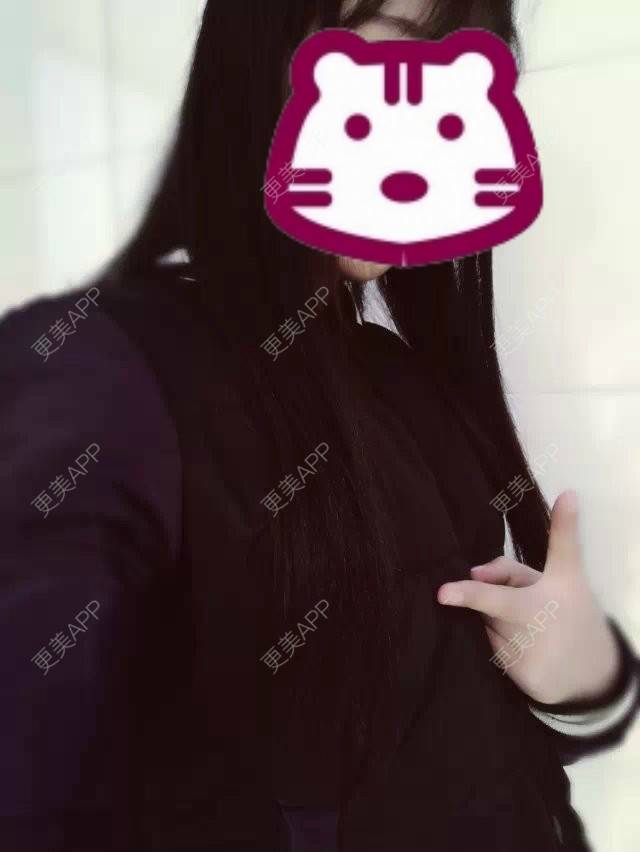 更美 - 眼泪画の婚礼桥的阴唇整形经验 | 上海 | 阴唇整形