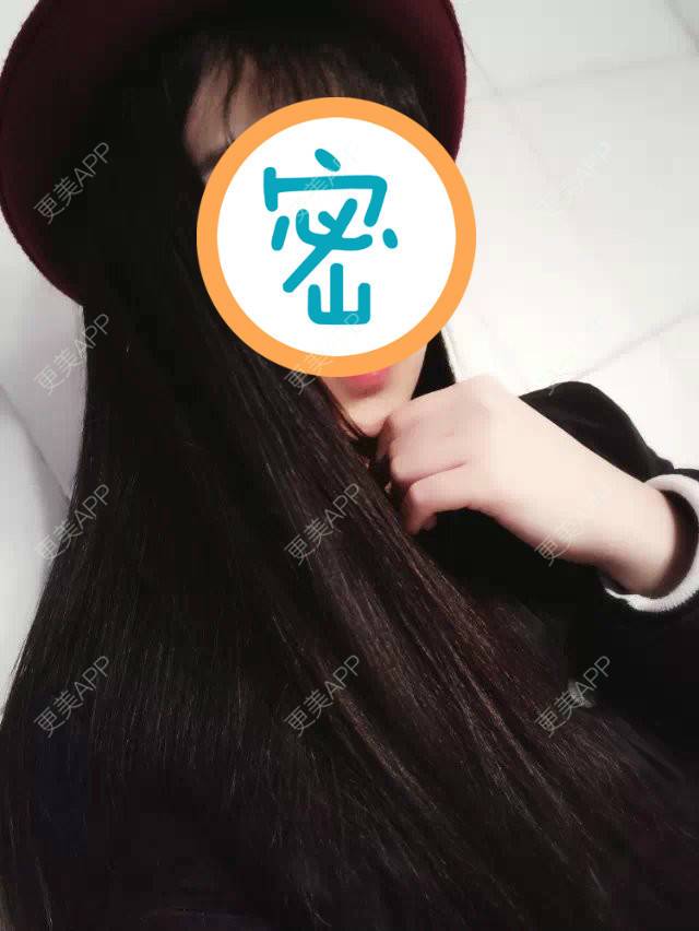 更美 - 眼泪画の婚礼桥的阴唇整形经验 | 上海 | 阴唇整形