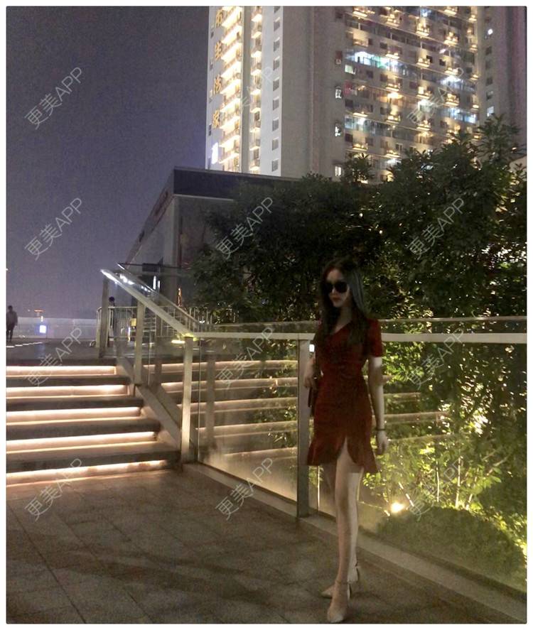 更美 - 更美用户R8khaDFdEz的吸脂瘦大腿经验 | 吸脂瘦大腿 | 深圳