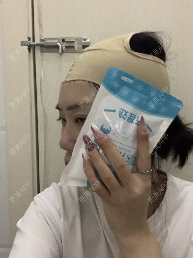 更美 - 月庭的下颌角切除经验 | 下颌角切除 | 下颌角整形 | 武汉