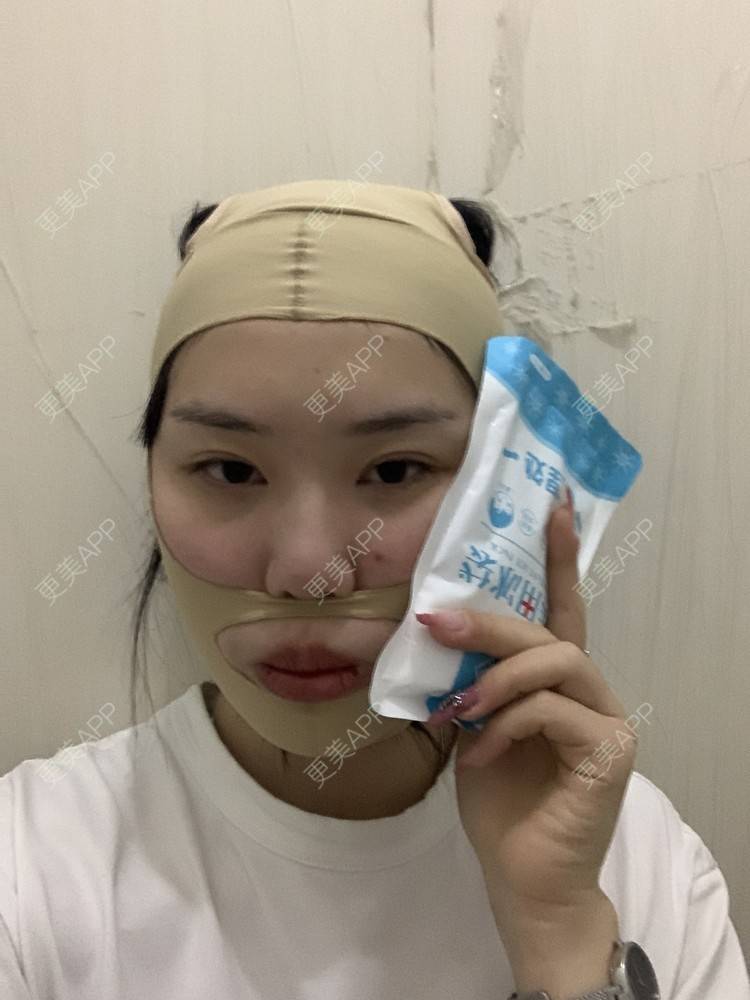 更美 - 月庭的下颌角切除经验 | 下颌角切除 | 下颌角整形 | 武汉