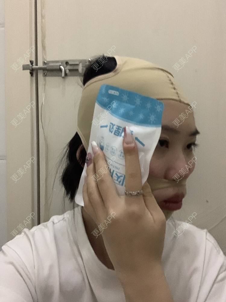 更美 - 月庭的下颌角切除经验 | 下颌角切除 | 下颌角整形 | 武汉