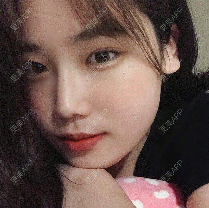 更美 - 更美用户SyRDHV9qdp的菲欧曼经验 | 菲欧曼