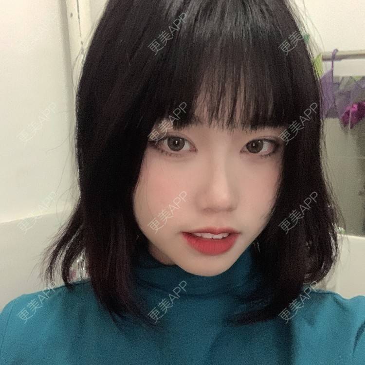 更美 - 月庭的下颌角切除经验 | 下颌角切除 | 下颌角整形 | 武汉