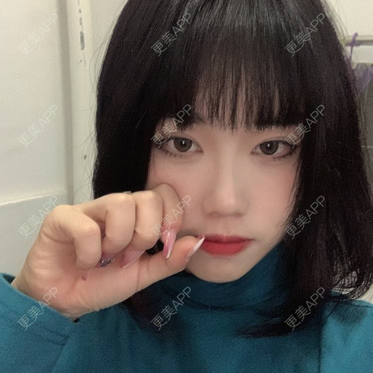 更美 - 月庭的下颌角切除经验 | 下颌角切除 | 下颌角整形 | 武汉