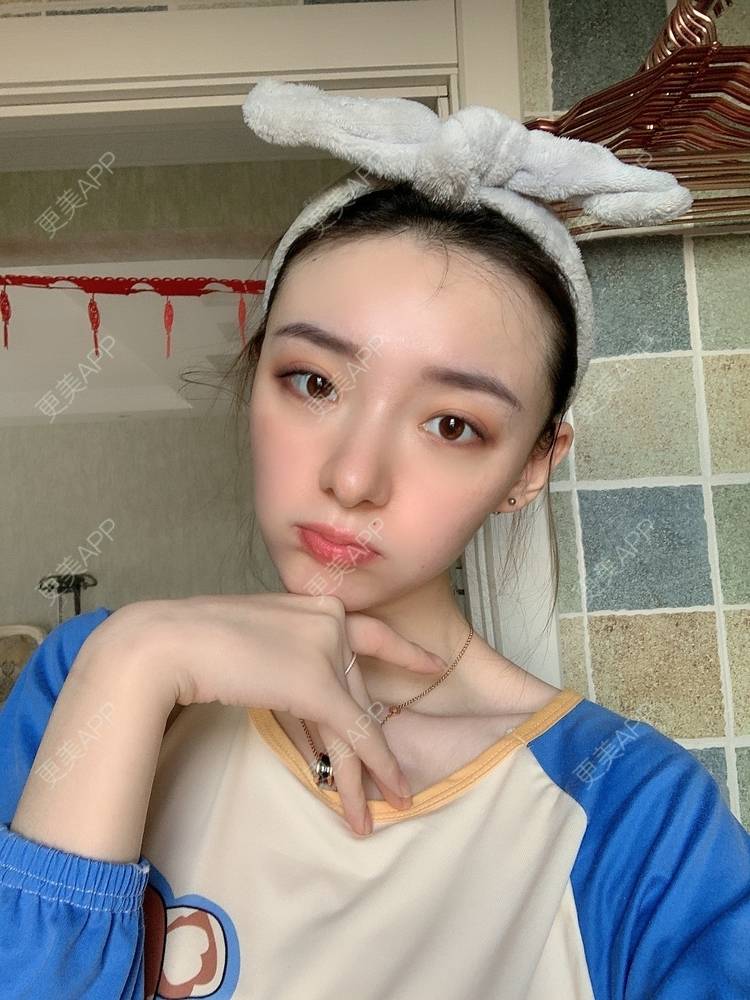 更美 - 更美用户fr8nl5Ywgd的颧弓降低经验 | 郑州 | 颧弓降低