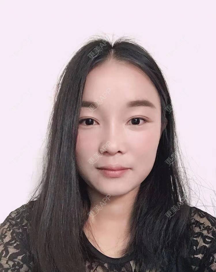 更美 - 见你好似见青山的鼻部多项经验 | 昆明 | 鼻部多项
