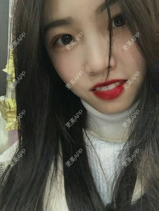 更美 - 更美用户mpyvE48XXs的眼部多项经验 | 郑州 | 眼部多项