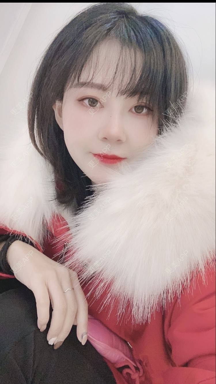 更美 - 更美用户prC91QaBHw的肋软骨隆鼻经验 | 信阳 | 肋软骨隆鼻