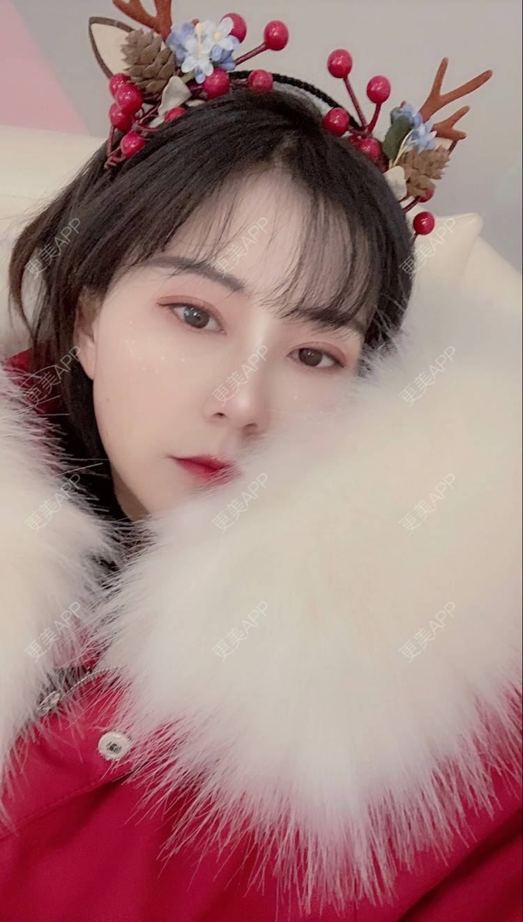 更美 - 更美用户prC91QaBHw的肋软骨隆鼻经验 | 信阳 | 肋软骨隆鼻