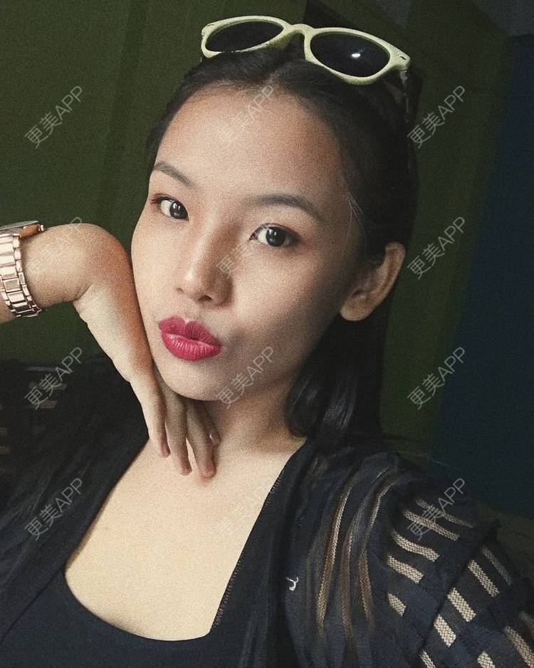 更美 - 更美用户Z2WtfrS6ld的水光项目经验 | 水光项目