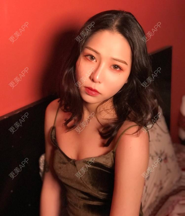 更美 - 更美用户npqbV13JPe的隆鼻经验 | 成都 | 视频日记 | 隆鼻