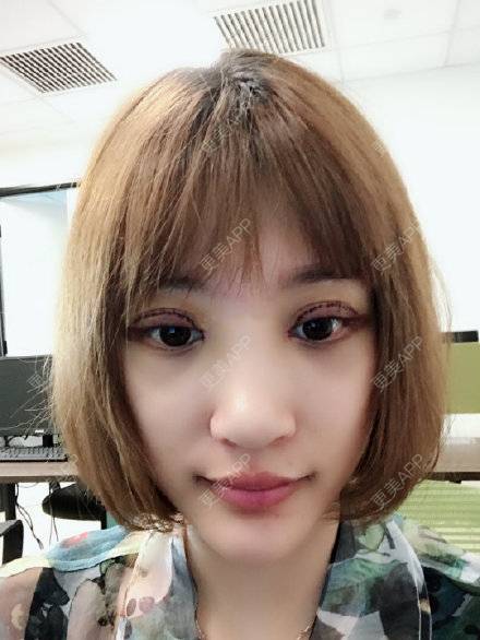 更美 - 更美用户4Iii004LB7的眼综合修复经验 | 眼综合修复 | 眼部修复 | 南京