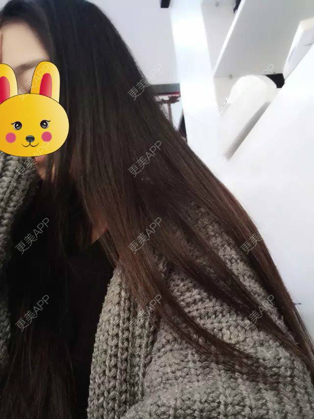 更美 - 最萌女生猎的阴唇整形经验 | 上海 | 阴唇整形