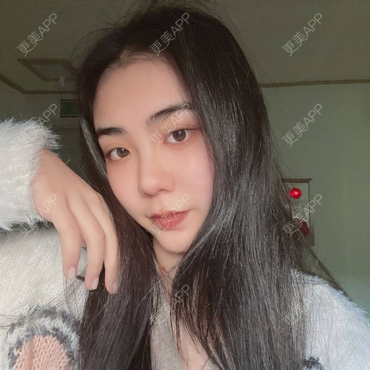 更美 - 昀昀一水间的颧骨颧弓整形经验 | 颧骨颧弓整形 | 下颌角整形 | 武汉