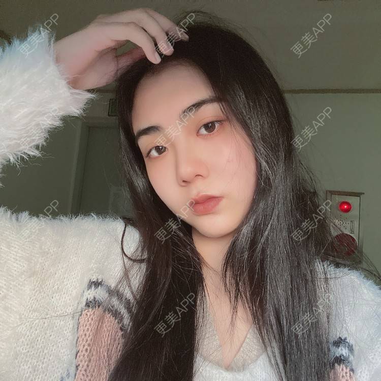 更美 - 昀昀一水间的颧骨颧弓整形经验 | 颧骨颧弓整形 | 下颌角整形 | 武汉