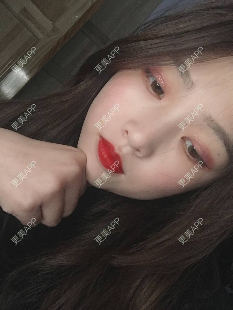 更美 - 更美用户mpyvE48XXs的眼部多项经验 | 郑州 | 眼部多项