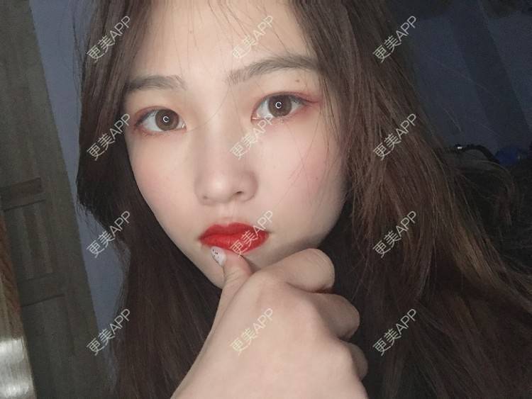 更美 - 更美用户mpyvE48XXs的眼部多项经验 | 郑州 | 眼部多项