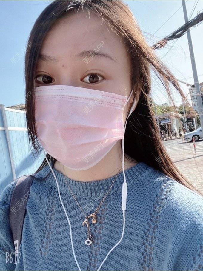 更美 - 更美用户wWwFqy0ZSh的水光项目经验 | 上海 | 水光项目
