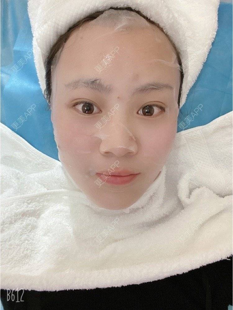 更美 - 更美用户wWwFqy0ZSh的水光项目经验 | 上海 | 水光项目