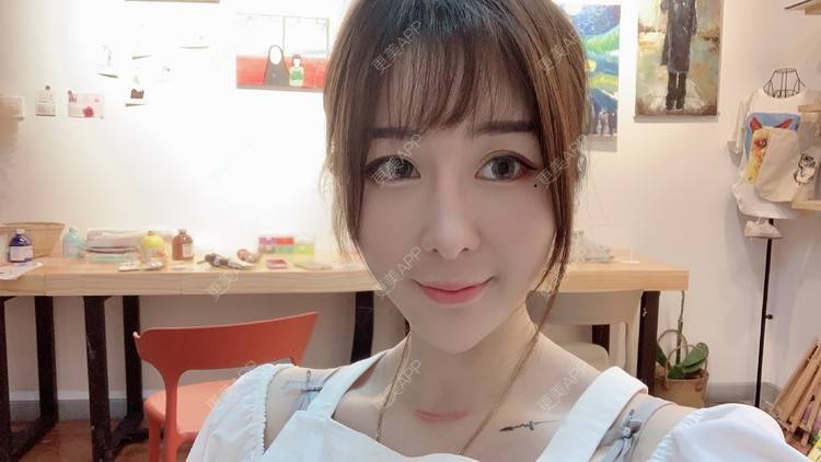 更美 - 呐呐😁的隆鼻经验 | 北京 | 视频日记 | 隆鼻
